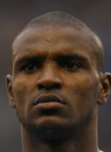 Abidal face 3