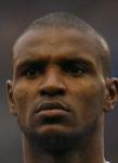 Abidal face 3